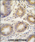 Lefty (LEFTB) Antibody (C-term)